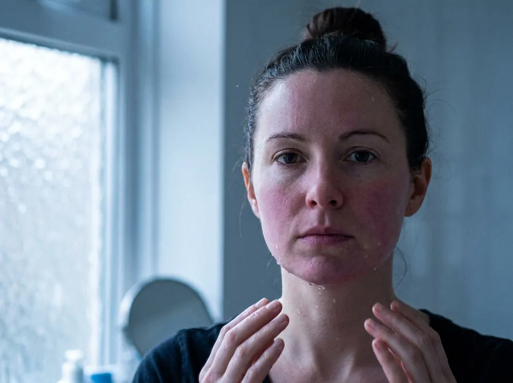 A woman's face beside a frosted bathroom window in cold blue daylight immediately after washing, her cheeks flushed and matte-tight with water still on her jaw and neck.