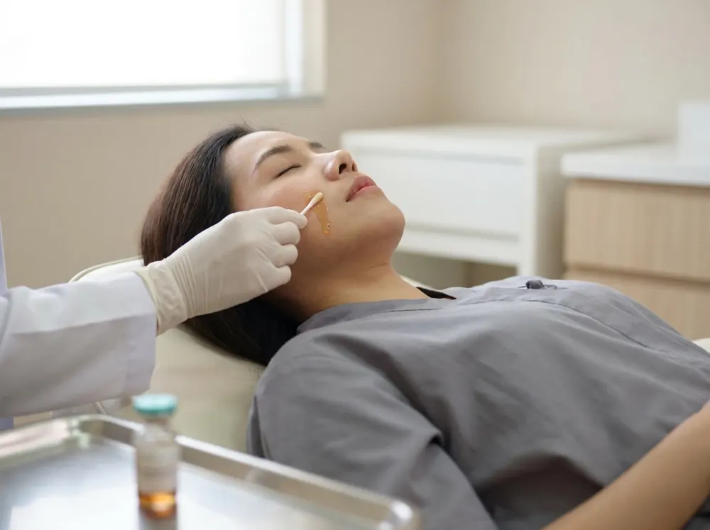 A practitioner applying a chemical peel solution to a client's cheek in a clinical setting