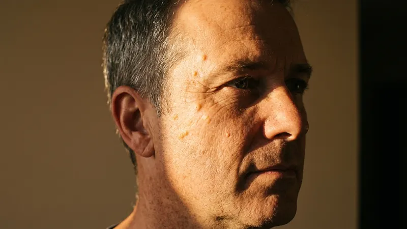 A man in his fifties with his face turned toward very low morning sun, several small yellowish bumps on his cheek and temple catching the raking light.