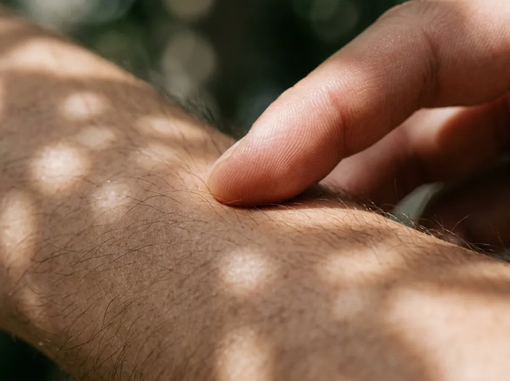 A fingertip pressed lightly onto a hairy forearm, with dappled patches of sunlight and shadow across the skin.