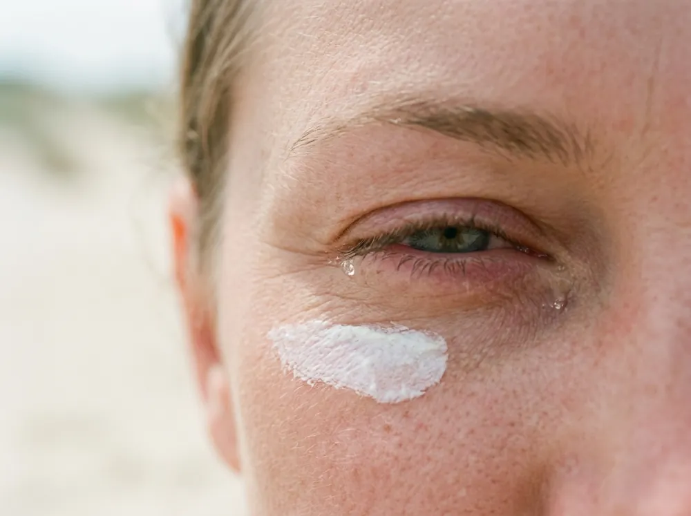 A close view of one eye narrowed with a tear at the lower lid and a thick white smear of sunscreen on the cheek just below, with a blurred sandy background.