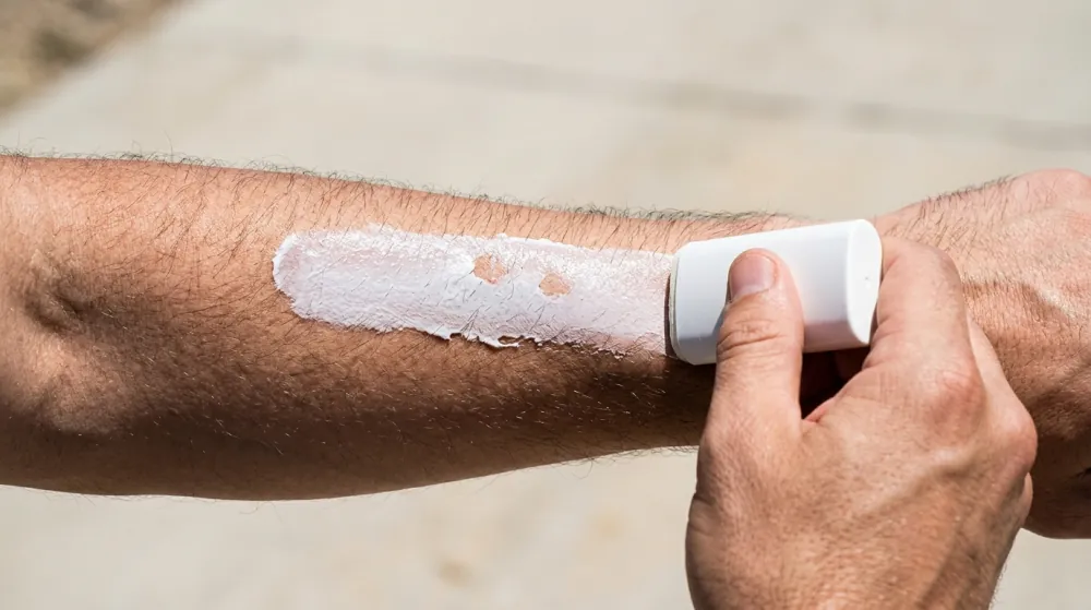 A man's forearm in bright sun with a thick, uneven white streak of sunscreen laid along it from a white stick held at its end, two small bare patches showing through the product.