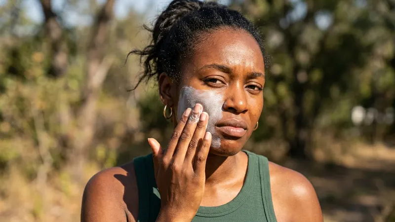 Sunscreen Without the White Cast: A Guide for Types IV–VI