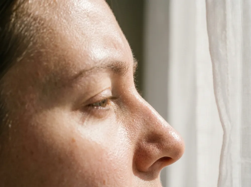 A forehead and nose in close profile with bright shiny highlights across the skin, pores and fine hairs visible, beside a sheer white curtain in warm sunlight.